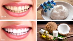 Coconut Oil Toothpaste